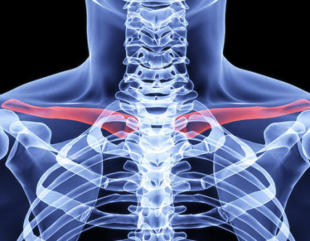 Κάταγμα της κλείδας / collarbone fracture